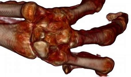 OIF 1 1 alien mummies