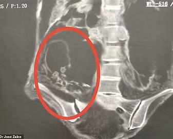 th 1 2 alien mummies